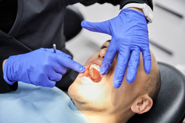 Best Emergency Wisdom Teeth Removal in Zilwaukee, MI